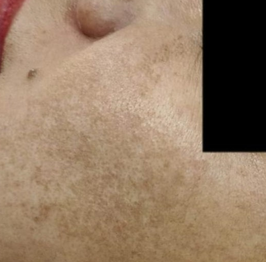 Before/After Image